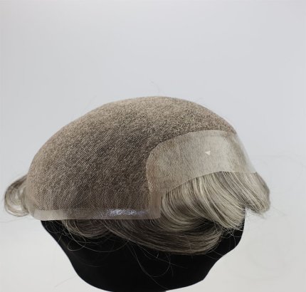 Hair Replacement Systems