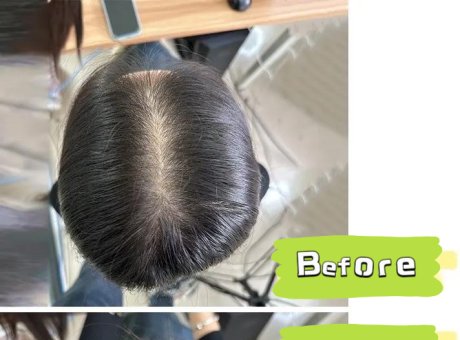 Common Mistakes of Wearing Hairpiece