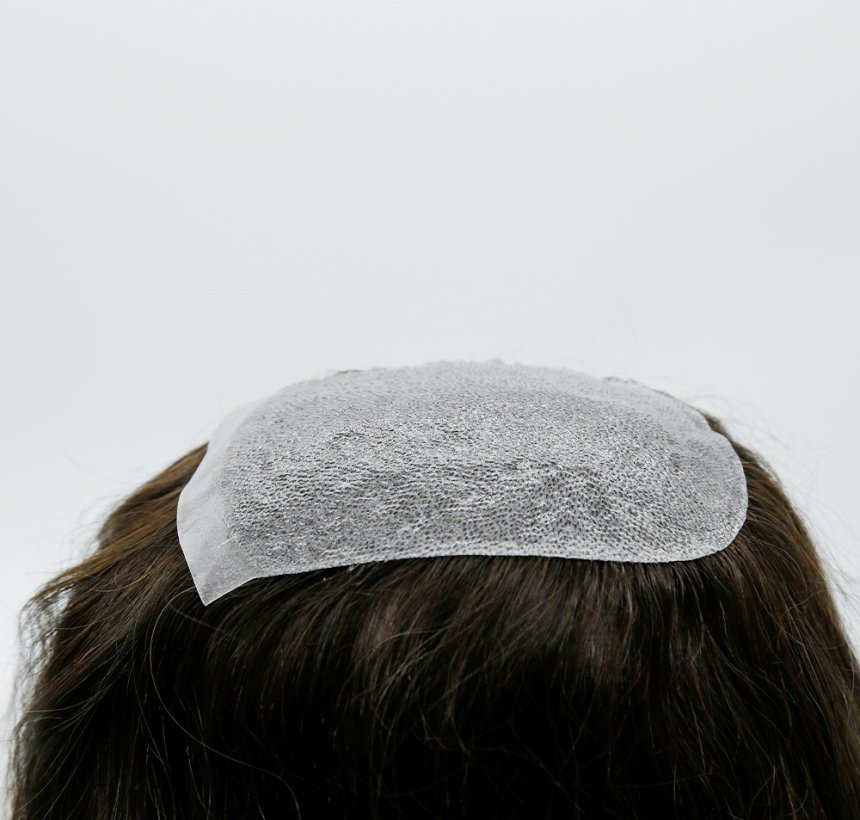 Skin Women Hair Replacement d