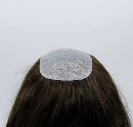 Skin Women Hair Replacement e